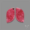 Pink Thulite Pair