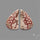 Orbicular Rhodochrosite Pair